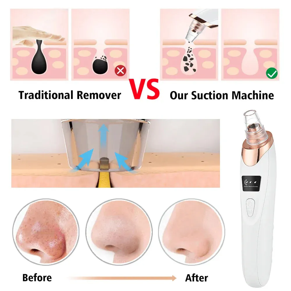 Deep Clean Blackhead Remover for Clear Skin